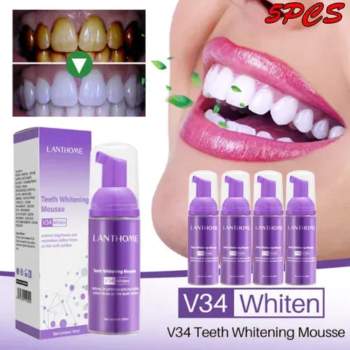 Blanchiment dentaire V34