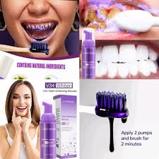 Blanchiment dentaire V34